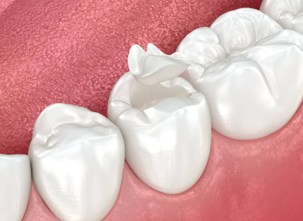 Best Wisdom Tooth Removal  in Lindsay, OK